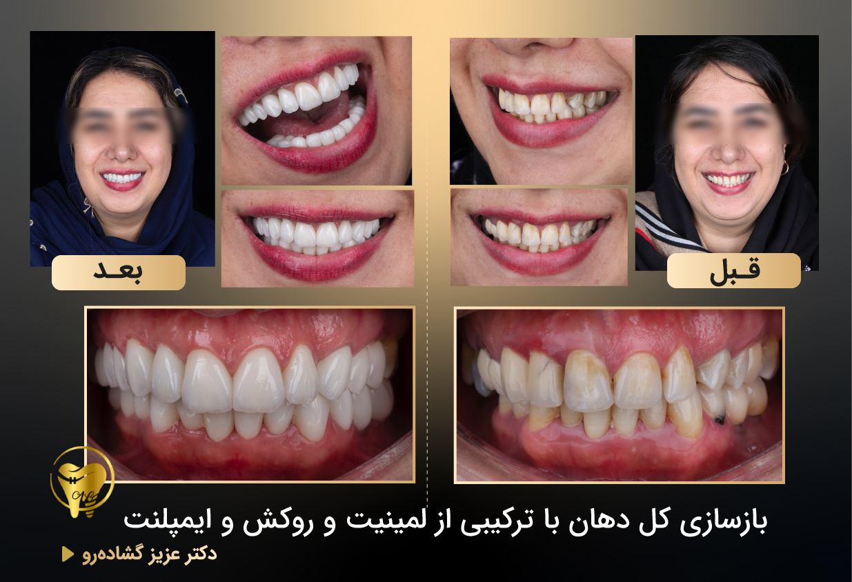 دکتر عزیز گشاده رو