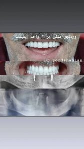 \"\"